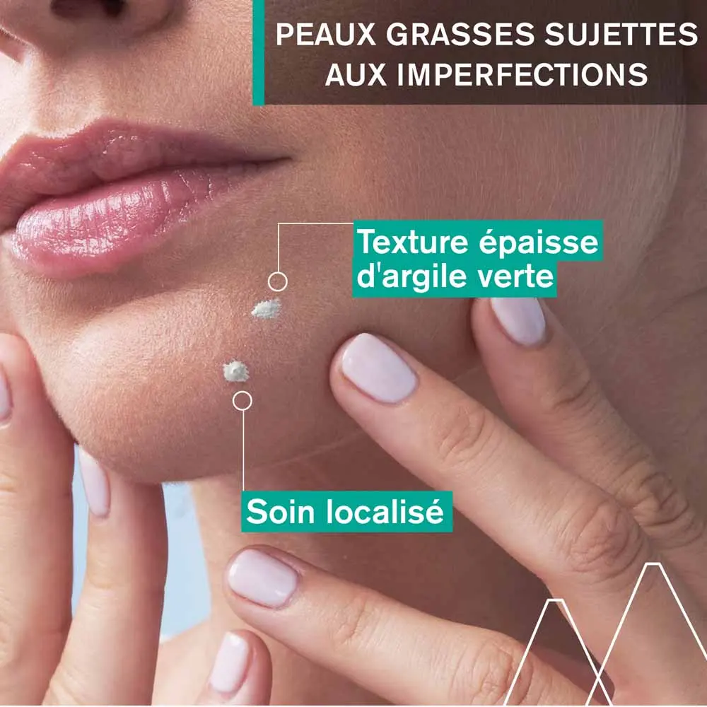 Uriage Hyséac Pâte SOS 15g – Image 5