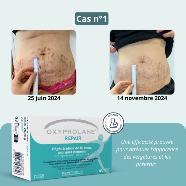 Oxyprolane® Repair – Régénération de la peau, vergetures – Image 5